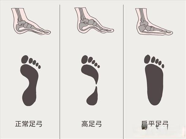 跑鞋脚型测试