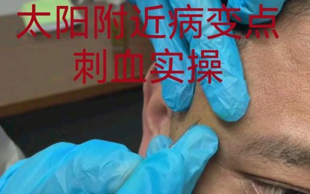 真正的杀牛视频放血