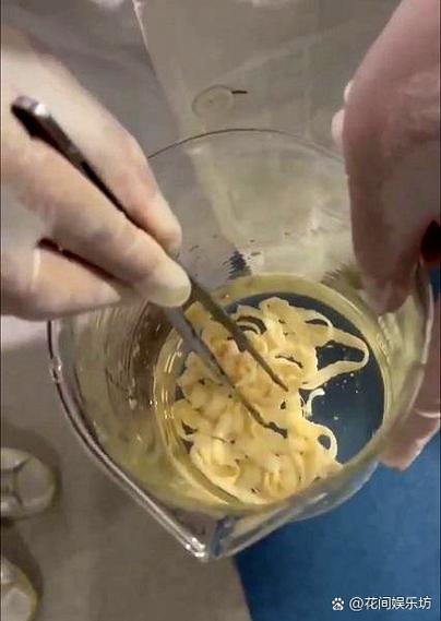 吃到寄生虫怎么办