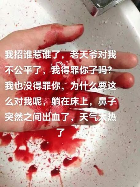 躺着突然起来流鼻血