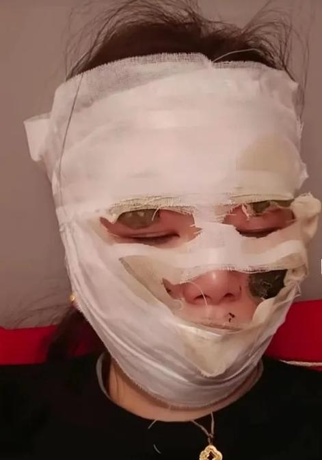 受伤的新娘