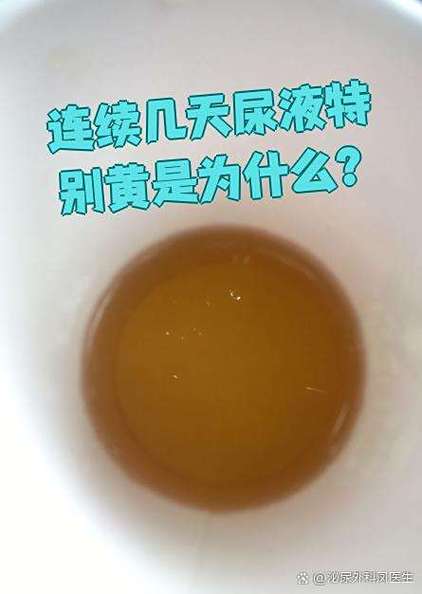 尿液黄