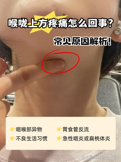 深喉第二天会喉咙痛吗