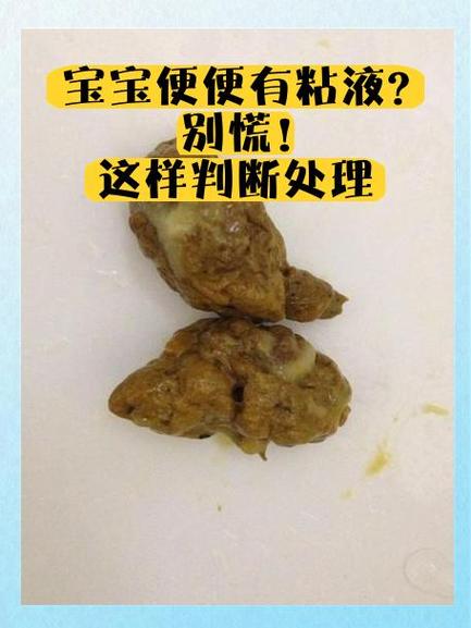 拉出果冻状粘液是怎么回事