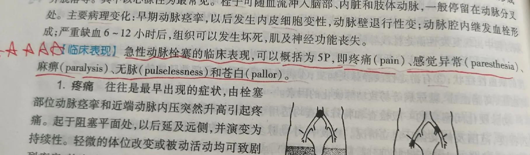 p5r异常状态