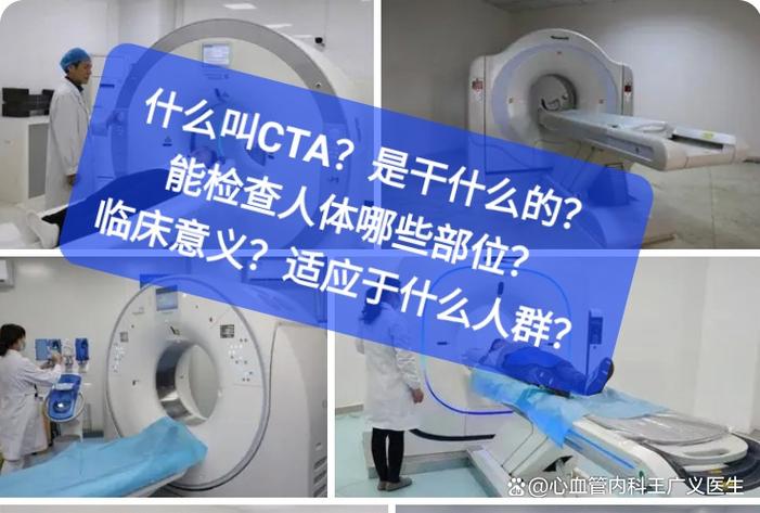 cta全称医学