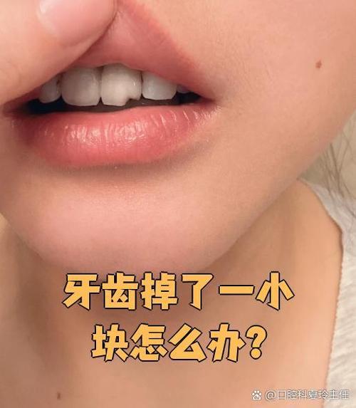 门牙磕掉一小块要紧吗