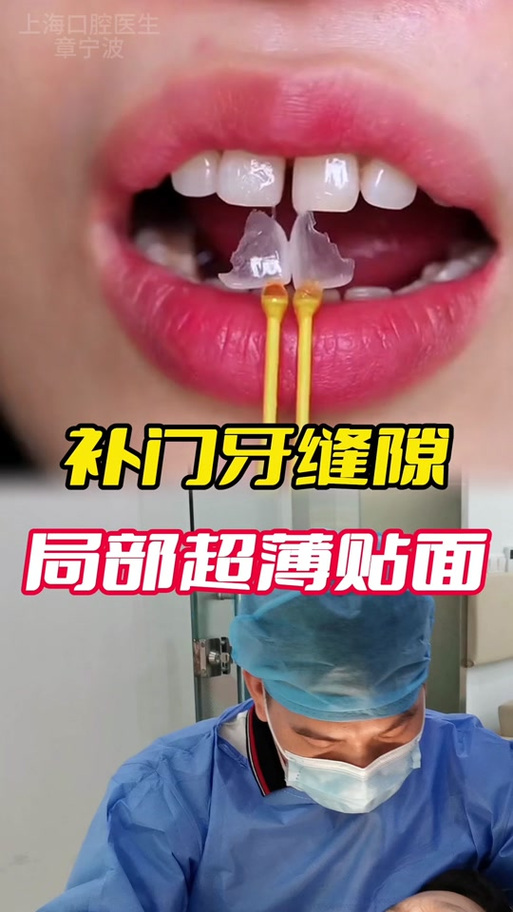 粘在瓷砖上的透明胶带