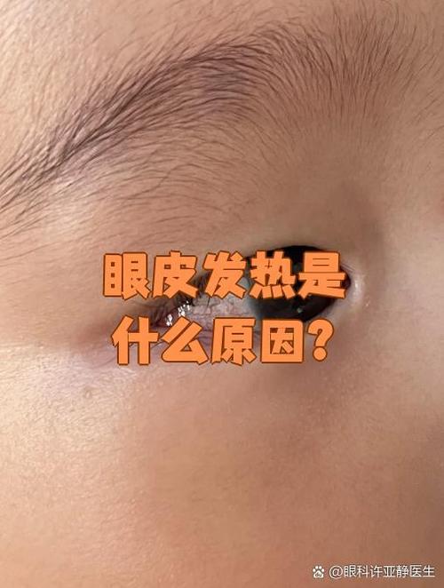 眼睛热热的是怎么回事