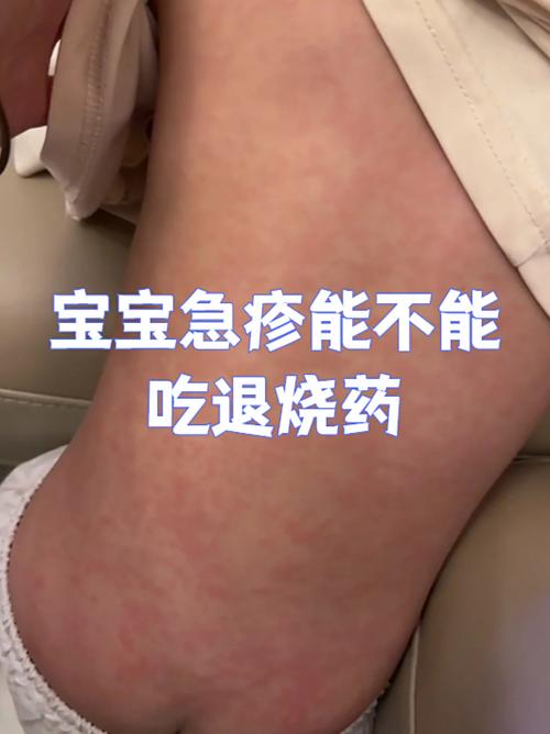 病毒感染的症状
