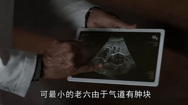 九分钟连生六胞胎