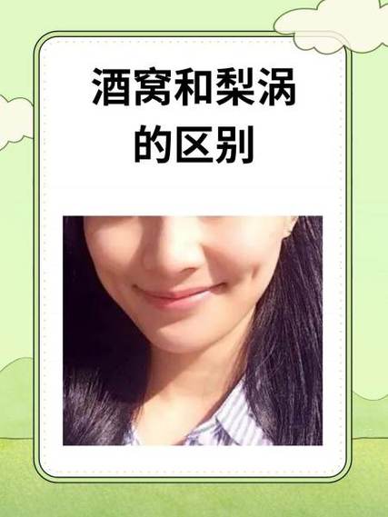 梨涡的位置在哪里截图