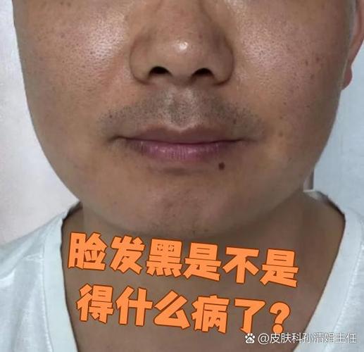 脸突然变黑了是为什么