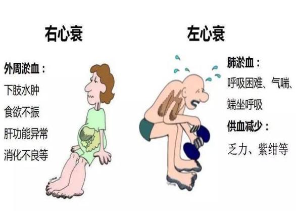 心衰最快的恢复办法