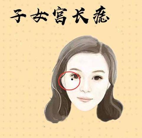 长吉痣