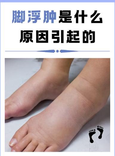 血糖高腿脚肿是什么原因?