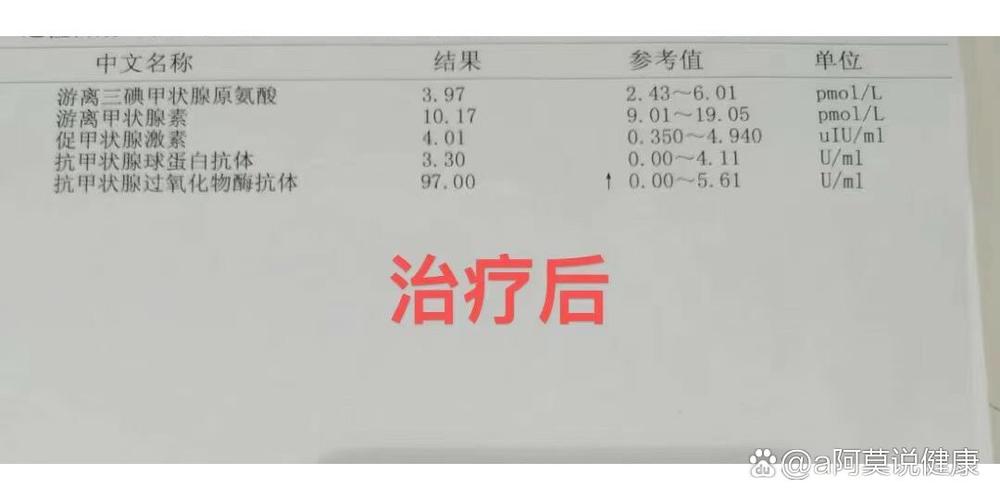 抗体超过1000了是桥本吗