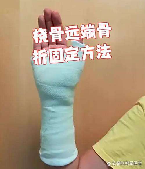 骨折治疗方法
