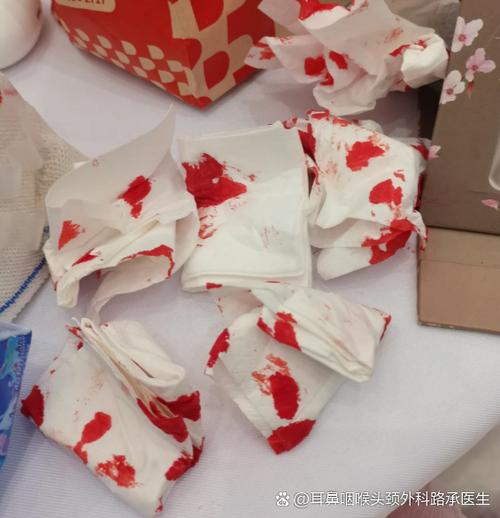 突然流鼻血真相揭秘