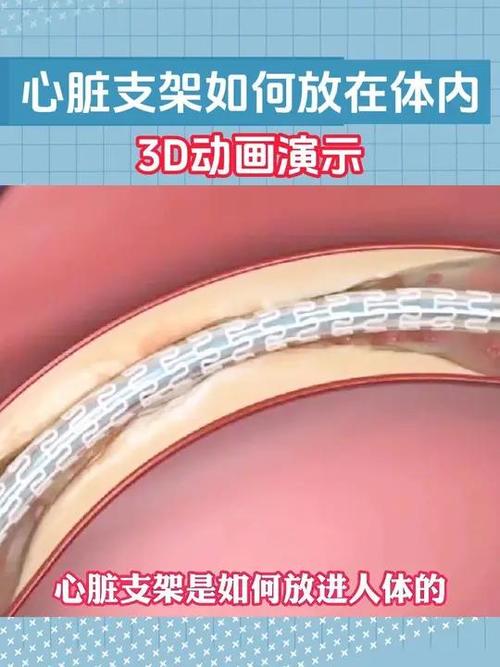 支架一次能放几个缩略图