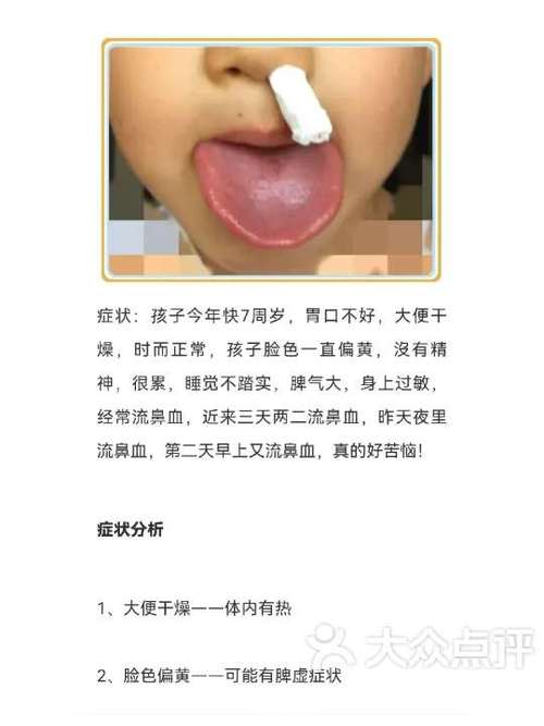 治小孩流鼻血偏方图标