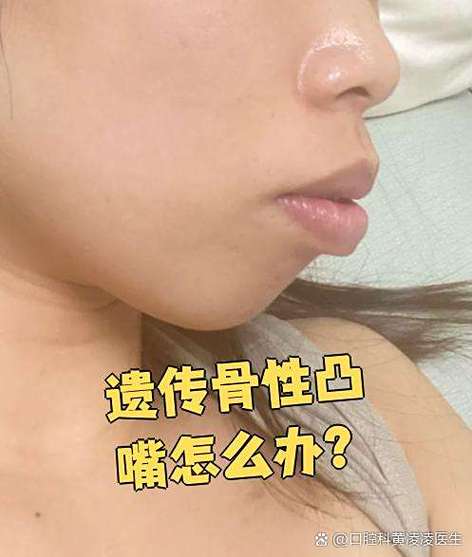 手腕处有个小骨头凸起缩略图