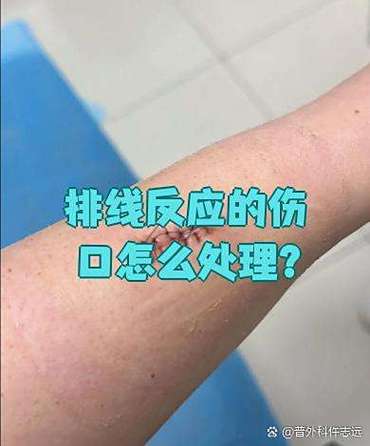 怎样判断是排线反应缩略图