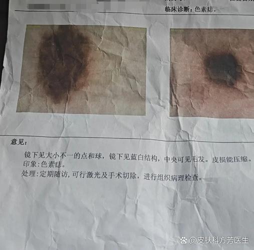 小米手机屏幕上有黑色的斑点缩略图