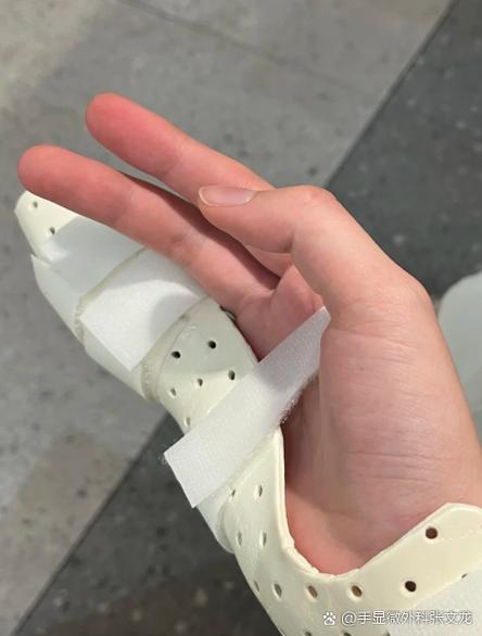 最简单把自己手指弄骨折方法