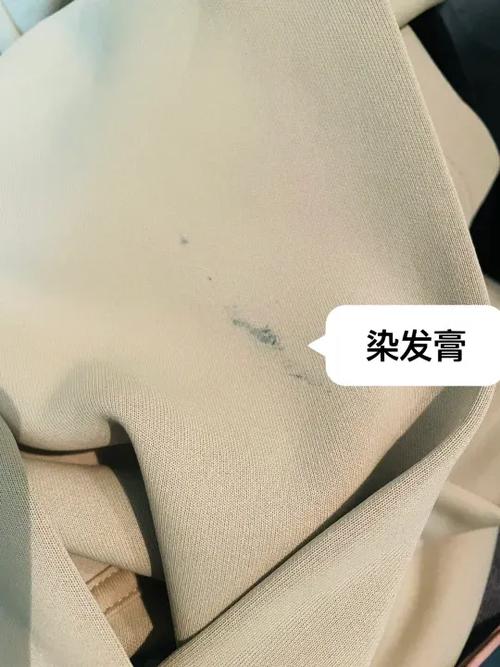 染发膏弄到衣服上怎么去除图标