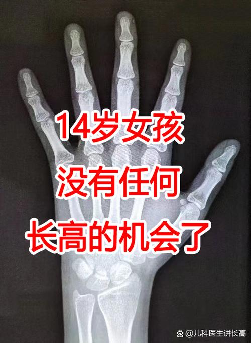 初中生14岁了两年没长高