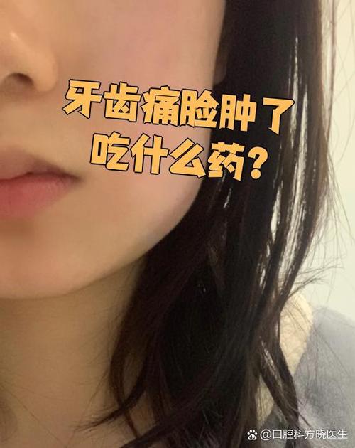 牙痛脸肿起来了吃什么药