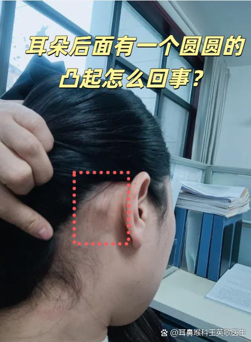 找到了圆圆的凸起图标