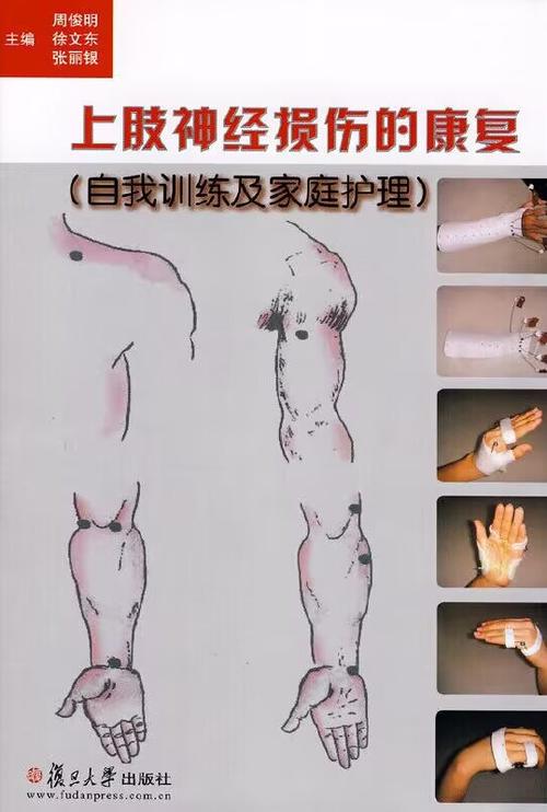 手臂康复训练6个动作