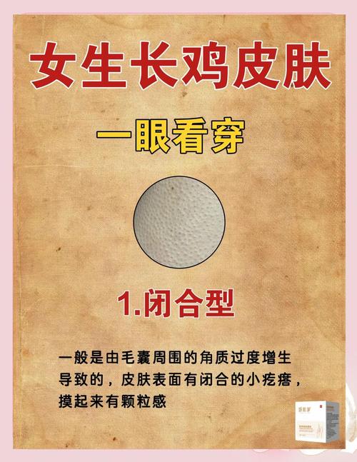 鸡上长了鸡皮疙瘩什么情况
