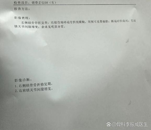 锁子骨断了手术多少钱
