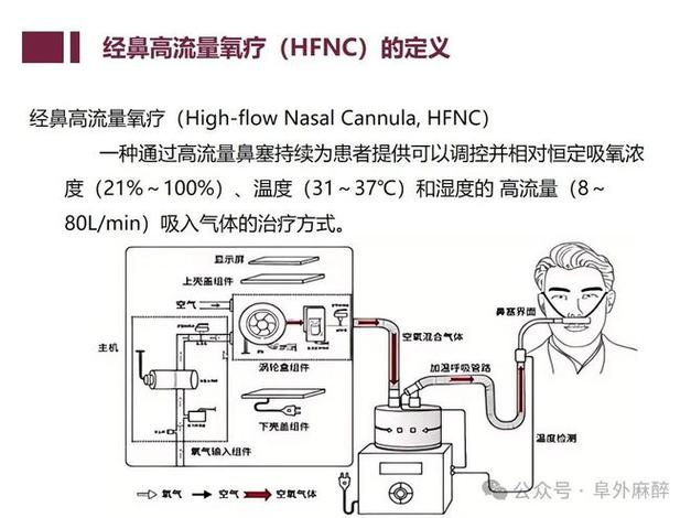 经鼻高流量氧疗参数调节