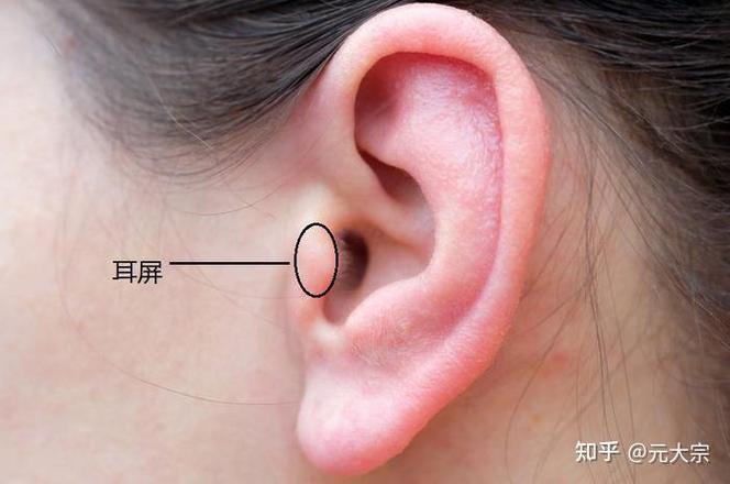 一只耳朵耳鸣另外一只正常游戏截图