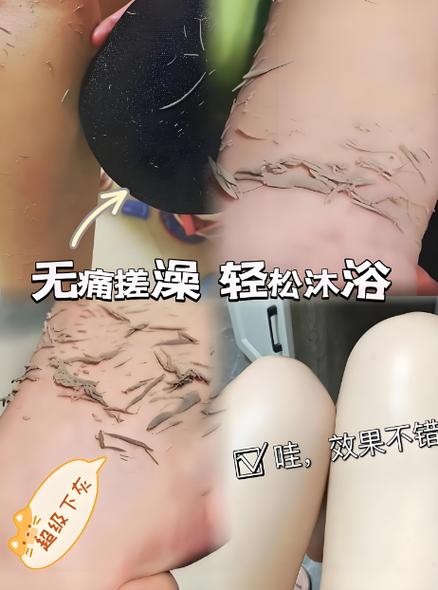 为什么喷了醋搓澡很下泥
