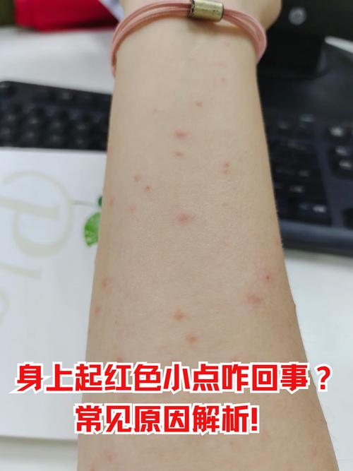 ios不升级怎么去掉红点