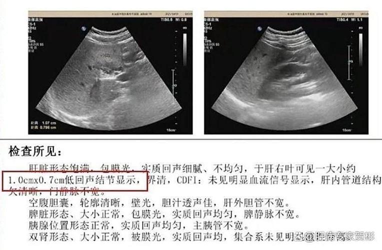 有回音是被监听了吗