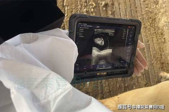 b超和彩超是一个意思吗