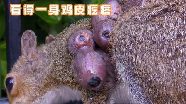 寄生虫从马桶中屁股钻进去寄生