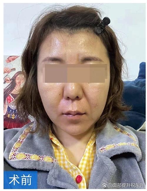苹果人脸化妆了就刷不开了截图