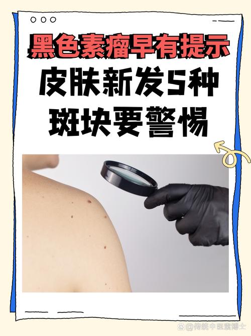 手机屏幕有黑点是什么原因