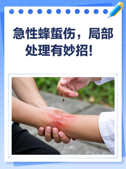 被蜜蜂蛰到手怎么办游戏截图