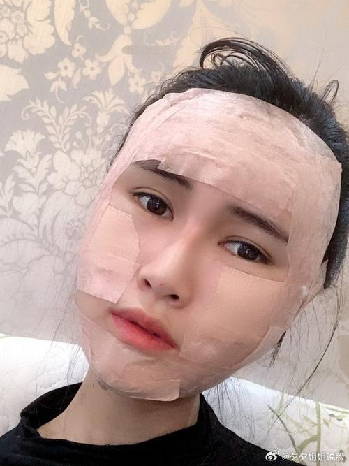 天气冷做脂肪填充好吗