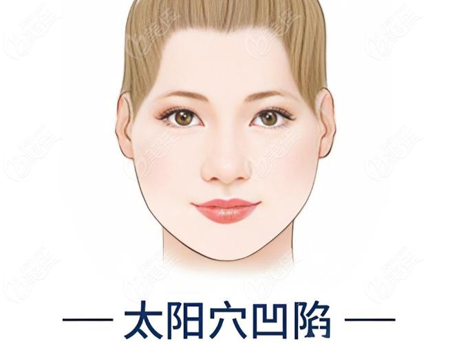 女人太阳凹陷十大征兆