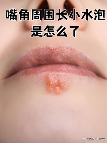 异鬼2病毒有什么症状