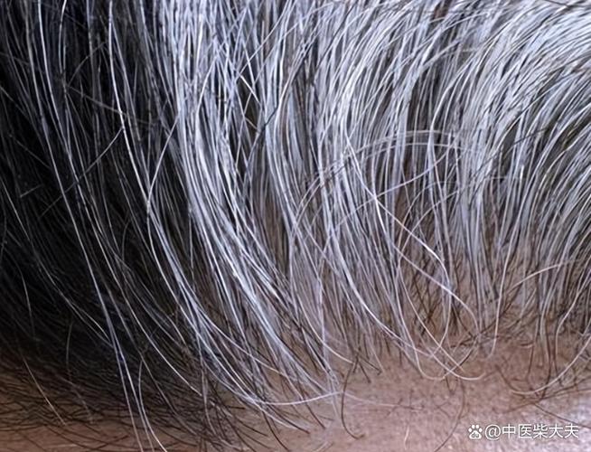 头发白吃什么药效果最好
